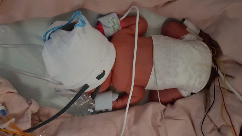 O'Brien baby in neonatal care