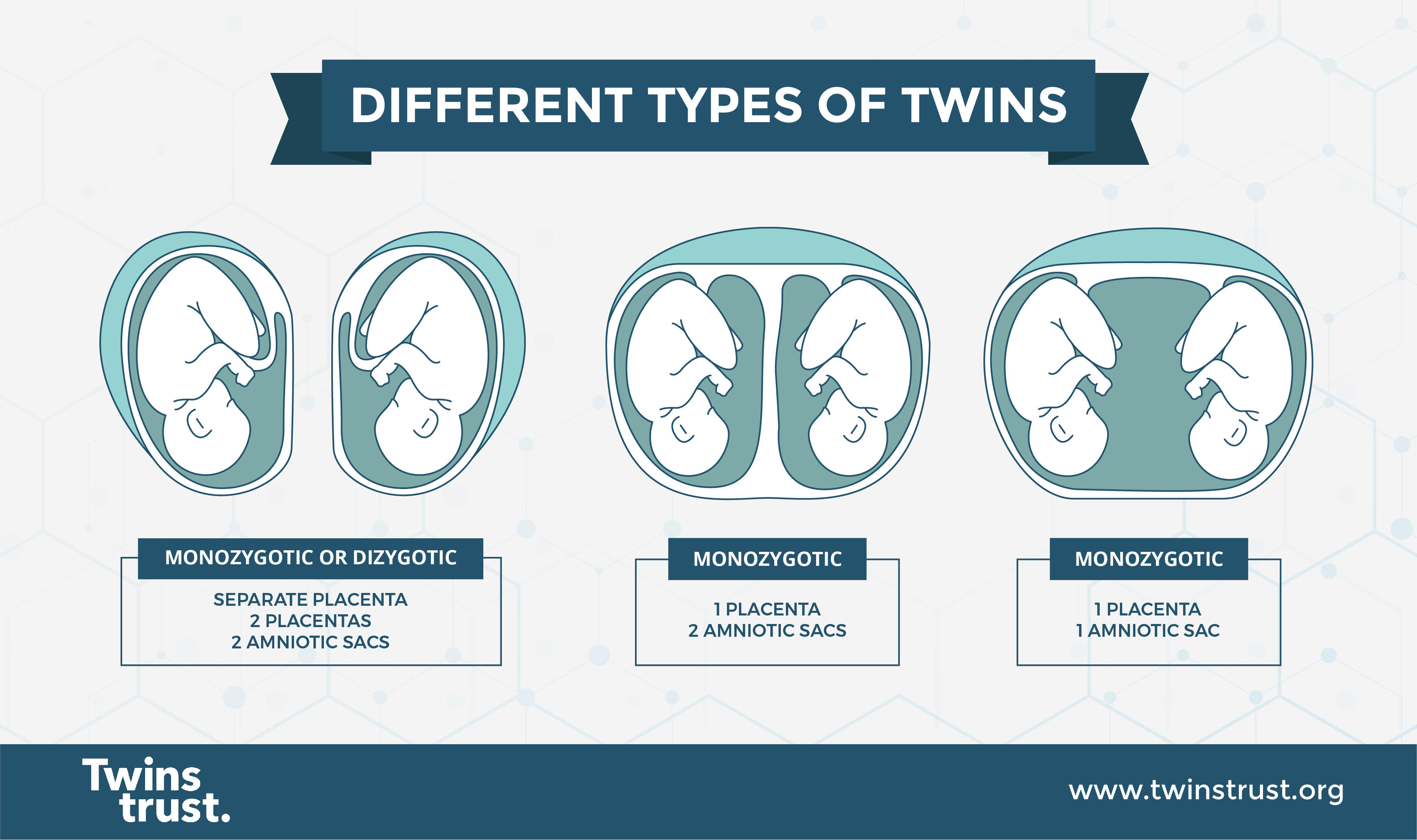 Monozygotic or dizygotic twins can have two placentas and two amniotic sacs. Monozygotic twins can have one placenta and two amniotic sacs. Monozygotic twins can have one placenta and one amniotic sac