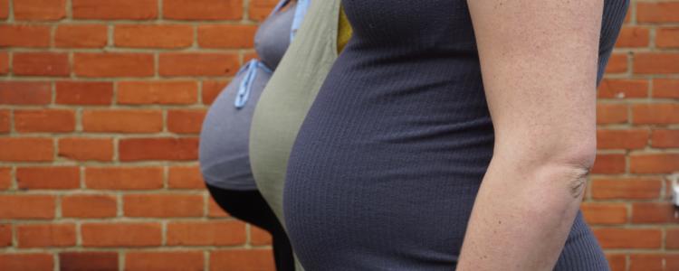 Three ladies pregnant with twins, triplets or more