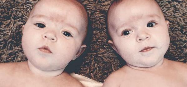 Photo of twin babies