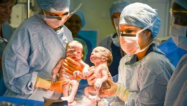 Newborn twins being delivered by caesarean